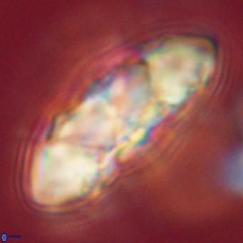 Senelia katapliktikos 67013