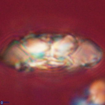 Senelia katapliktikos 67018