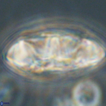 Senelia katapliktikos 67029