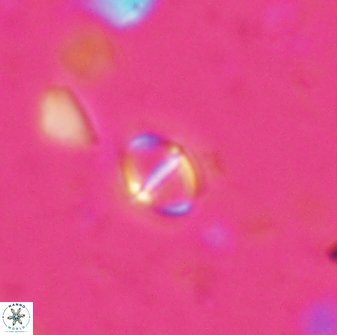 Solidopons petrae 26750