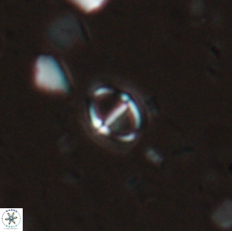 Solidopons petrae 26751