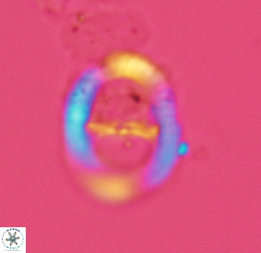 Speetonia colligata 2964