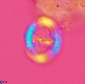 Speetonia colligata 3578