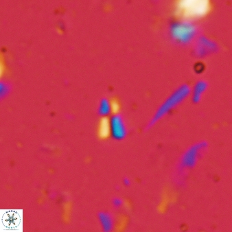 Sphenolithus compactus 123