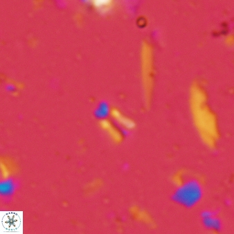 Sphenolithus compactus 125