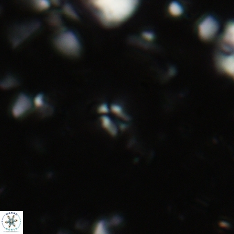 Sphenolithus compactus 89