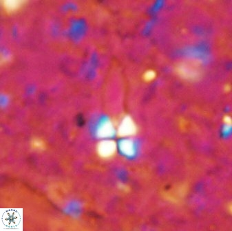 Sphenolithus conspicuus 49013