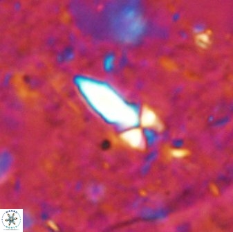 Sphenolithus conspicuus 49015