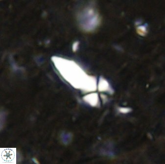 Sphenolithus conspicuus 49016