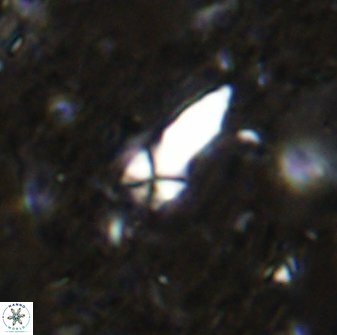 Sphenolithus conspicuus 49017