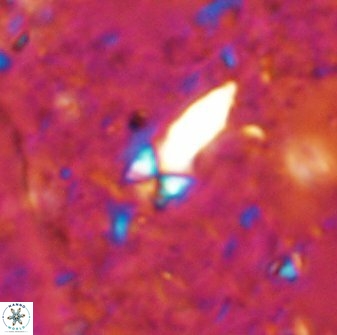 Sphenolithus conspicuus 49018