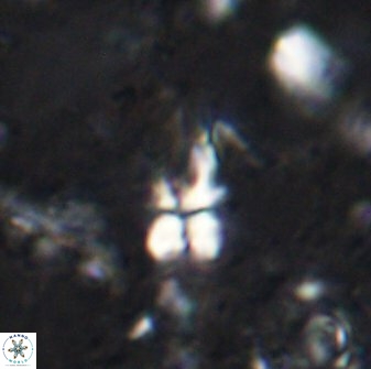 Sphenolithus conspicuus 49220