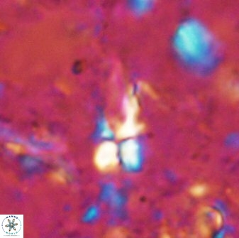 Sphenolithus conspicuus 49221