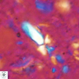 Sphenolithus conspicuus 49222