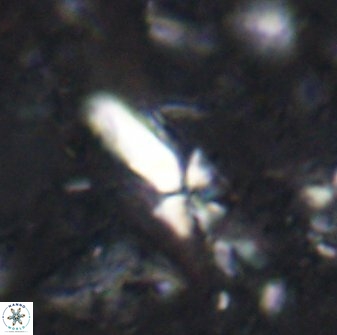 Sphenolithus conspicuus 49223