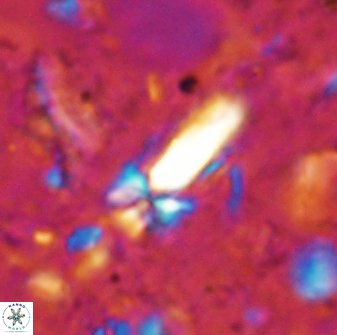 Sphenolithus conspicuus 49225