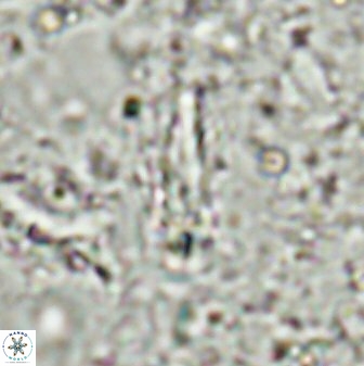 Sphenolithus conspicuus 49226