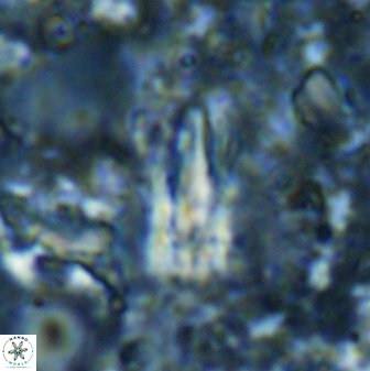 Sphenolithus conspicuus 49227