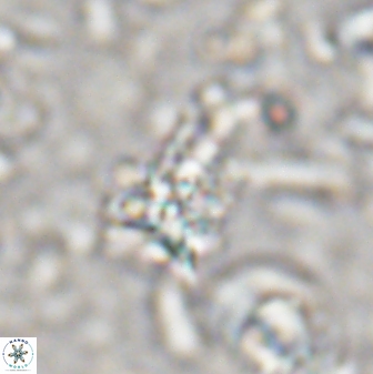 Sphenolithus calyculus 28007