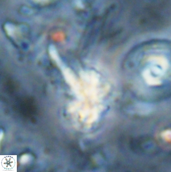 Sphenolithus calyculus 28009