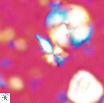 Sphenolithus calyculus 28014