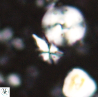 Sphenolithus calyculus 28015