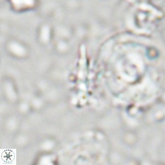 Sphenolithus calyculus 28016