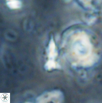 Sphenolithus calyculus 28017
