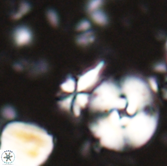 Sphenolithus calyculus 28013