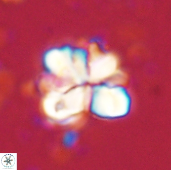 Sphenolithus cf bouketo 43023