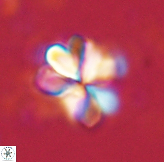 Sphenolithus cf bouketo 43024