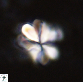 Sphenolithus cf bouketo 43025