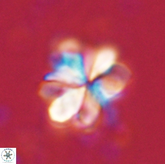 Sphenolithus cf bouketo 43029