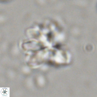 Sphenolithus cf bouketo 43030