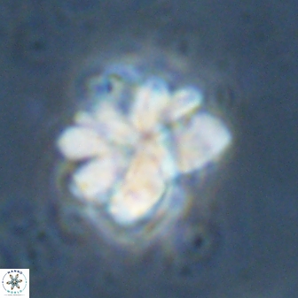 Sphenolithus cf bouketo 43032