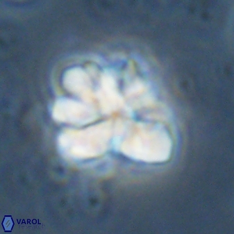 Sphenolithus cf bouketo 43033