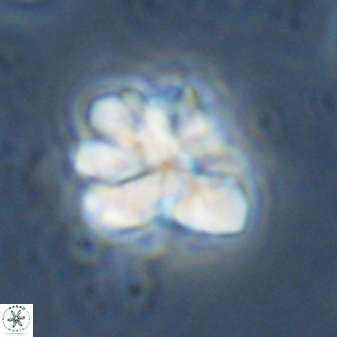 Sphenolithus cf bouketo 43033