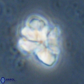 Sphenolithus cf bouketo 43034