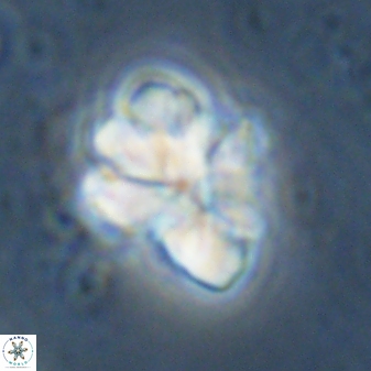 Sphenolithus cf bouketo 43034