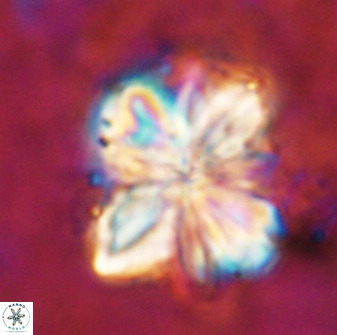 Sphenolithus cf bouketo 49632