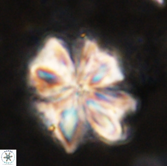 Sphenolithus cf bouketo 49633