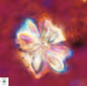 Sphenolithus cf bouketo 49634