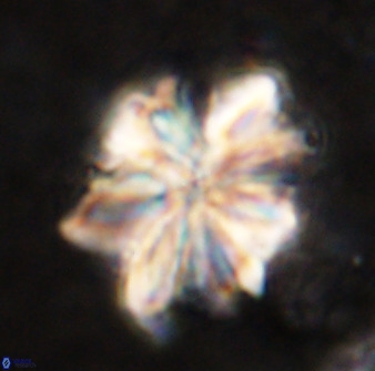 Sphenolithus cf bouketo 49636