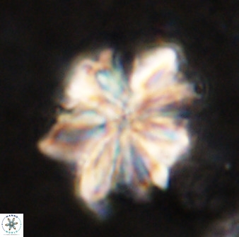 Sphenolithus cf bouketo 49636