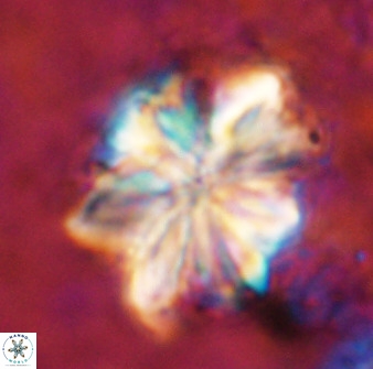 Sphenolithus cf bouketo 49637