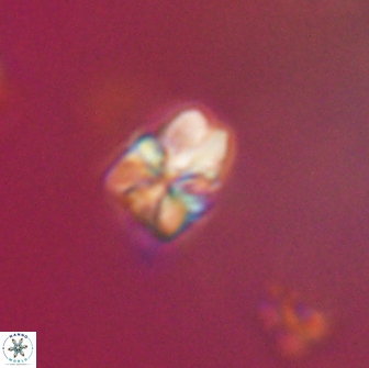 Sphenolithus cf didymikoryfi 64424