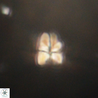 Sphenolithus cf didymikoryfi 64427