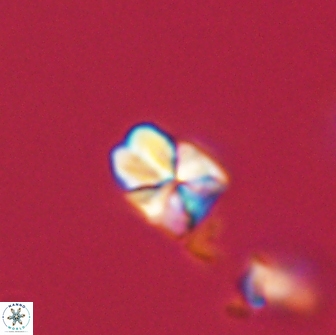 Sphenolithus cf didymikoryfi 64434