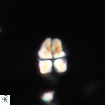 Sphenolithus cf didymikoryfi 64430