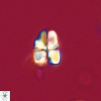 Sphenolithus cf didymikoryfi 64454